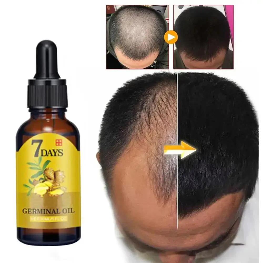 Ingrown Hair Serum - Minyak esensial penumbuh rambut, minyak jahe