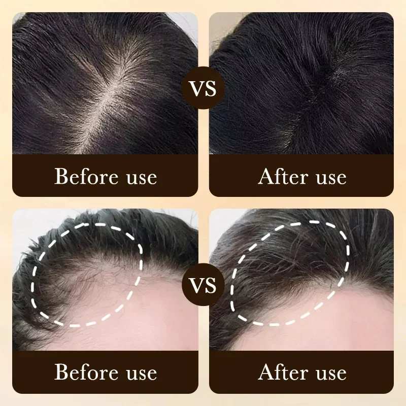 Produk Minyak Penumbuh Rambut  - Ingrown Hair Serum ulasan dan harga