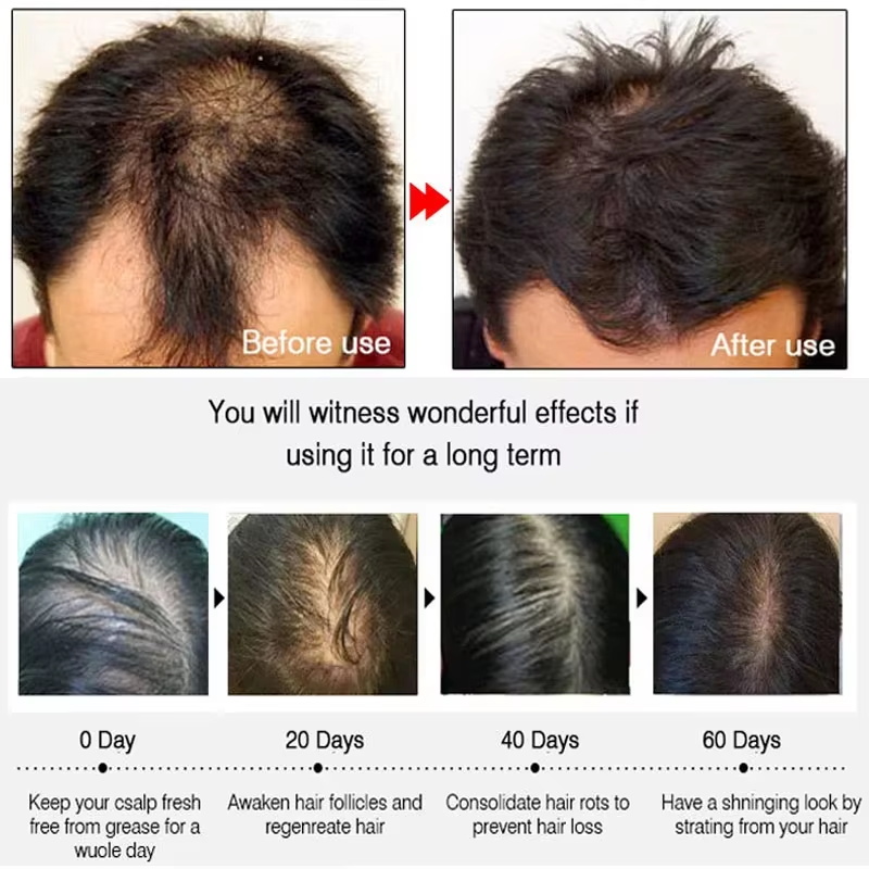 Semprotan Penumbuh Rambut Jahe - Ingrown Hair Serum ulasan dan harga
